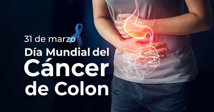 El cáncer de colon aumentó entre los  jóvenes: el 90% de los casos puede curarse si se detecta a tiempo